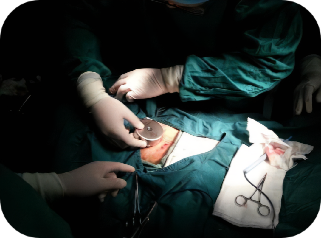 El último uso de testosterona — implantación subcutánea