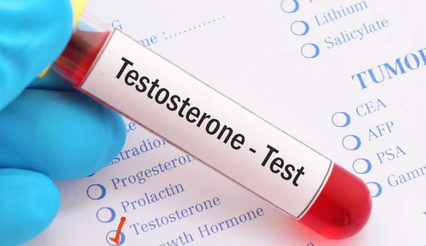Test Propionate vs Test Cypionate: Short ester is more beneficial to maintain the function of HPTA